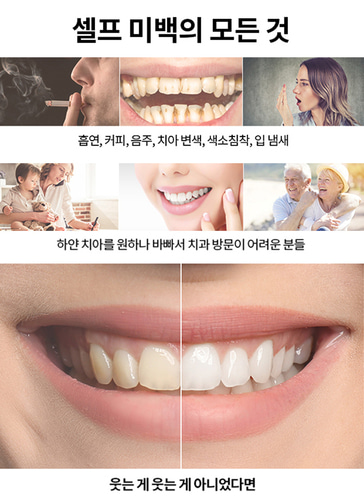 화이트 치약 치과 미백성분 잇몸 구강관리